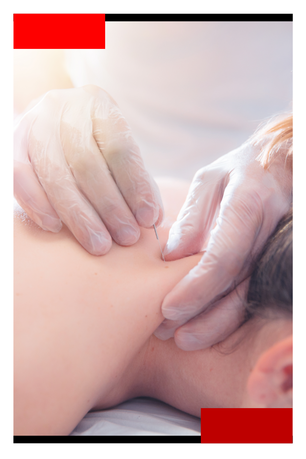 Young woman receiving acupuncture treatment